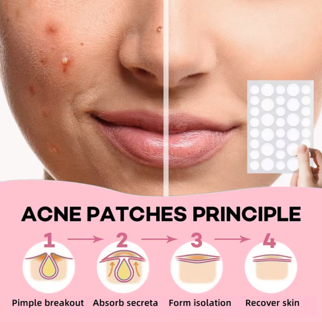 Invisibile Pimple Patches